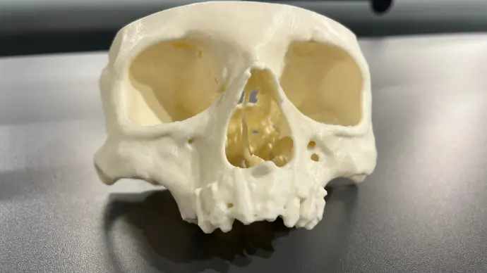 Maquete cirurgica em 3D